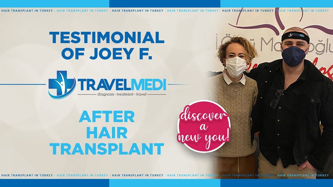 FUE Hair Transplant Reviews