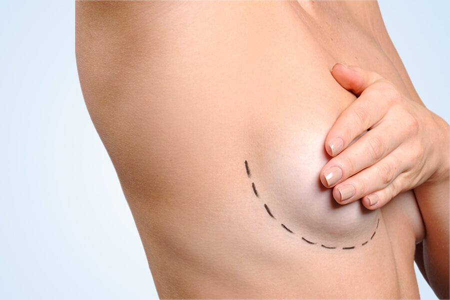 Breast Enlargement Cost in Turkey Breast Enlargement Cost in Turkey
