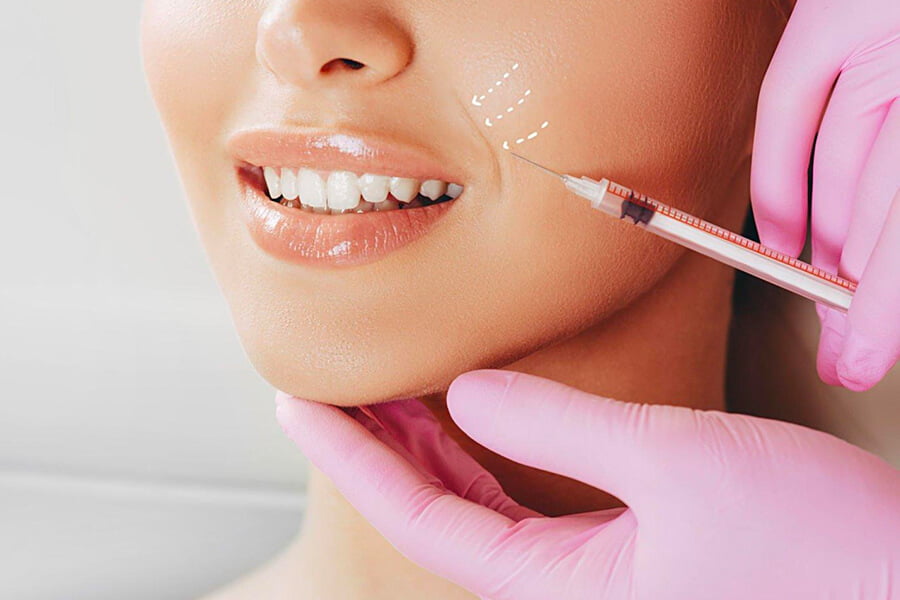 Dermal Fillers