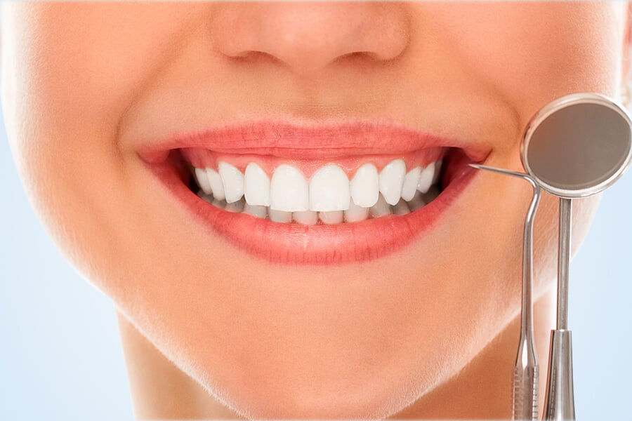 Teeth Whitening and Bleaching