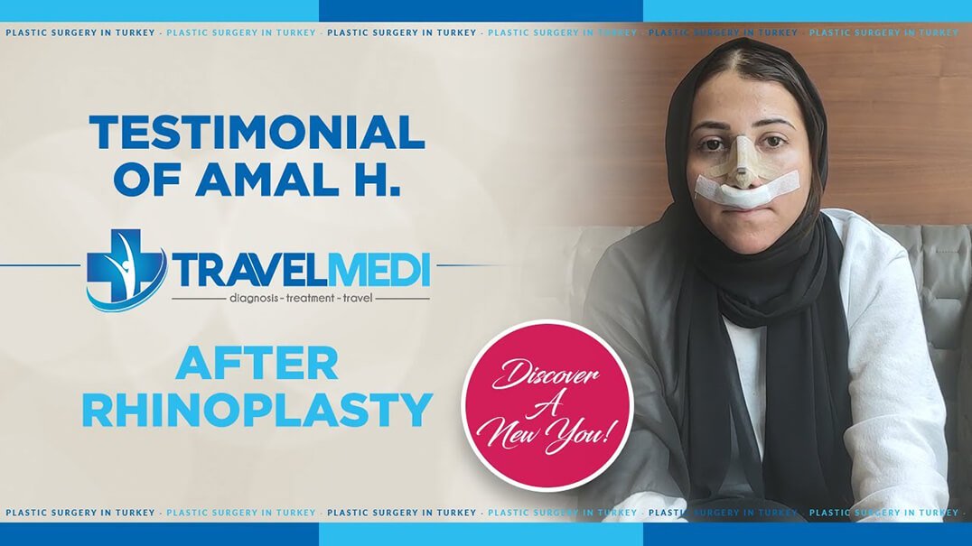 Amal video testimony after nose job operation